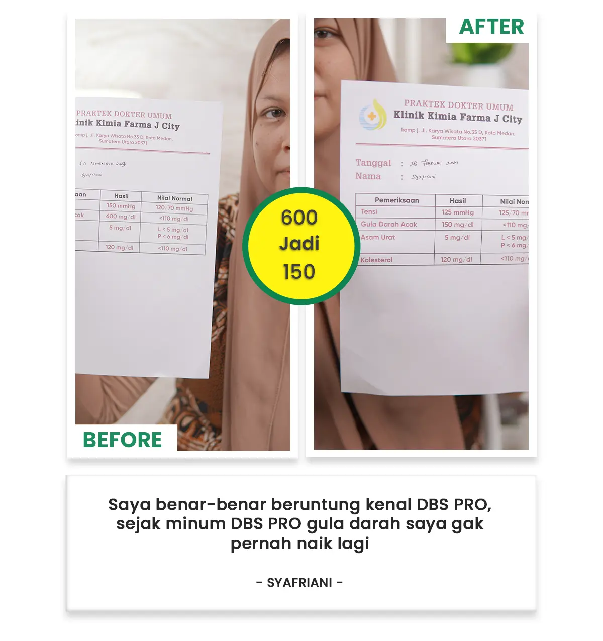 Before After 01