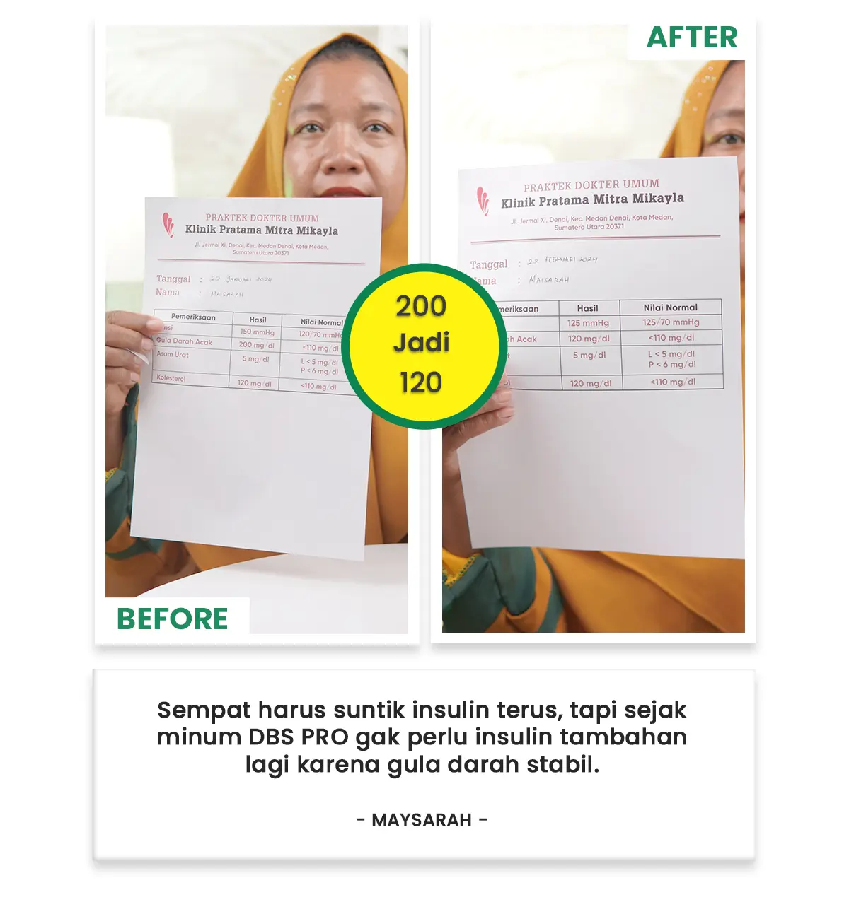 Before After 02