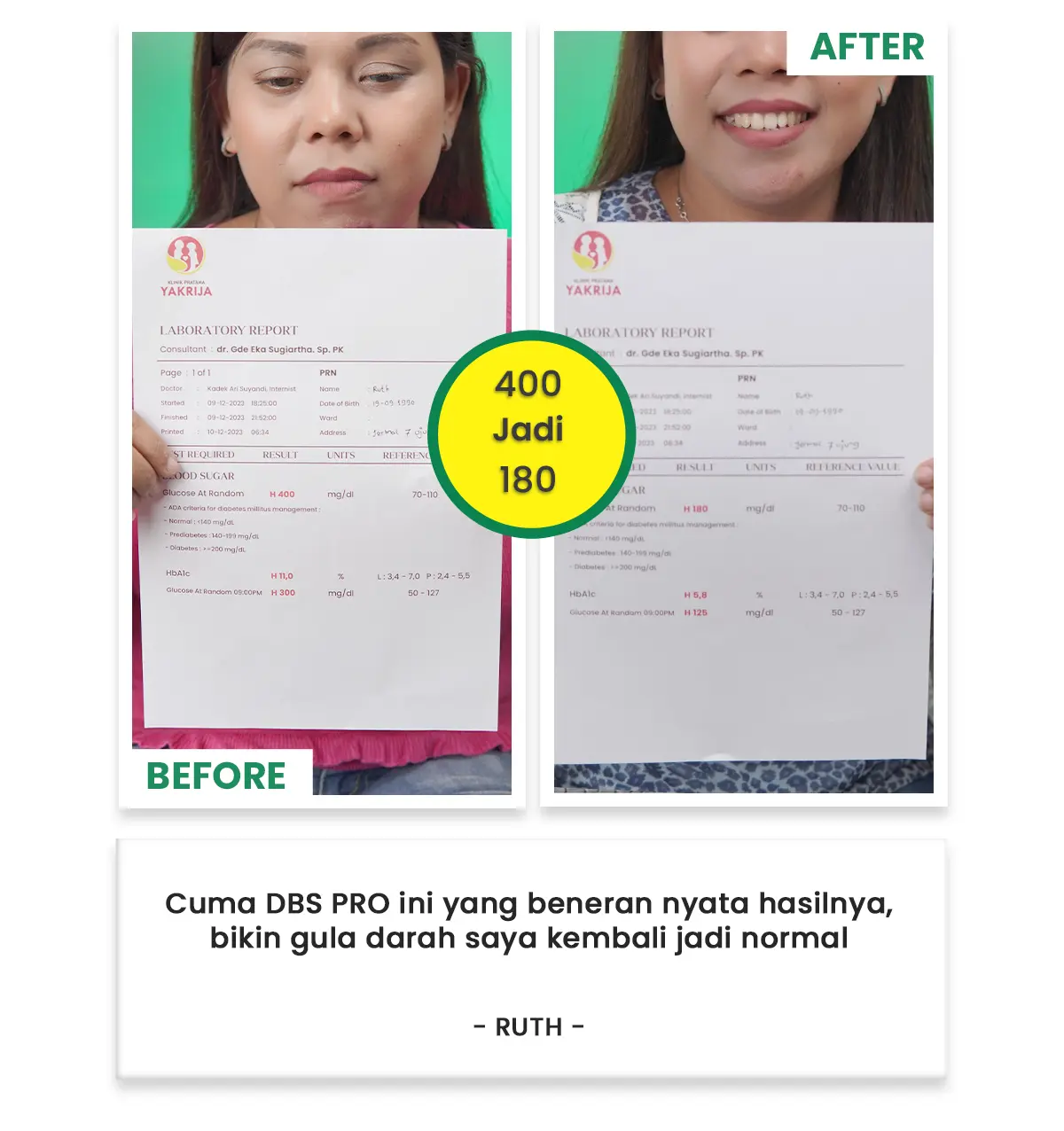 Before After 03